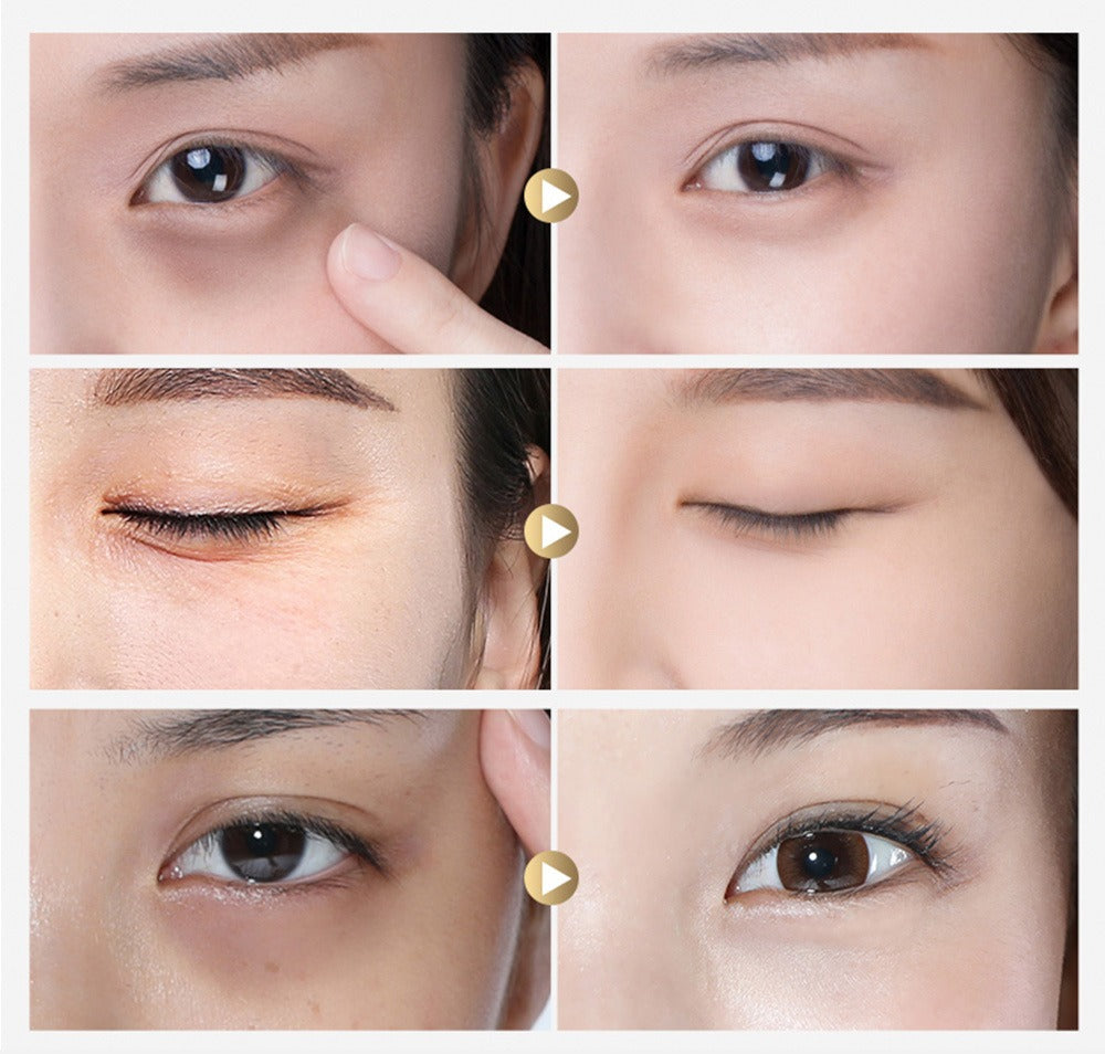 LANBENA Gold Black Pearl Hydra-gel Eye Patches 30 pairs 去眼袋珍珠啫喱眼膜 30對